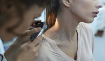 Sergipe deve ter mais de dois mil casos de câncer de pele em 2023