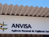 Anvisa suspende venda e propaganda de “chips da beleza”