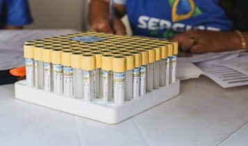 Lacen já realizou 2.517 testes para detecção do câncer de próstata